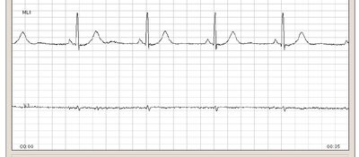 BEATLab: Software para a visualización e anotación do Electrocardiograma