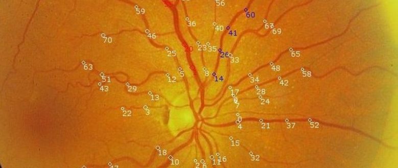 SIRIUS: Sistema para a Integración de Servizos de Procesamento de Imaxes da Retina