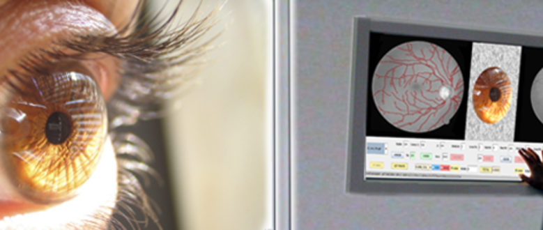 Novas técnicas de visión artificial para diferenciar arterias e venas en imaxes de anxiografía retiniana