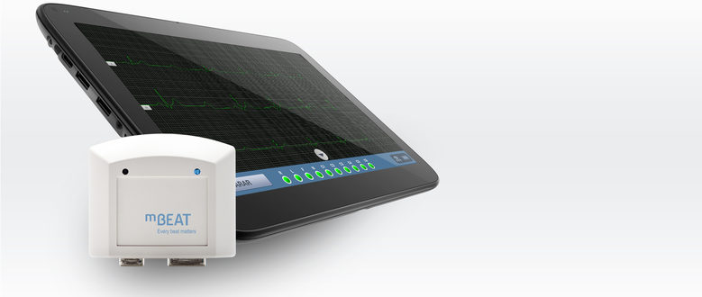 MBEAT HOME EDITION: Sistema de telemonitorización intelixente ubicuo e en tempo real de pacientes crónicos con patoloxías cardiovasculares