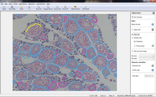 GOVOCITOS: Software para a estimación da fecundidade en peixes analizando imaxes histolóxicas