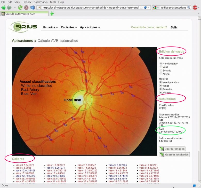 SIRIUS: Sistema para a Integración de Servizos de Procesamento de Imaxes da Retina